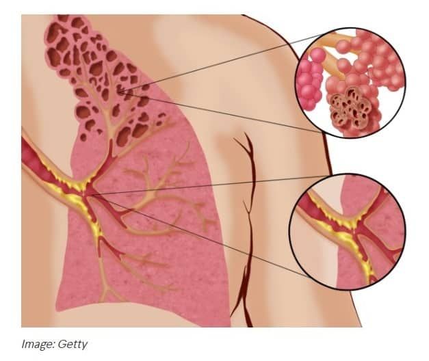 Understanding Vaping’s Impact on Heart Health