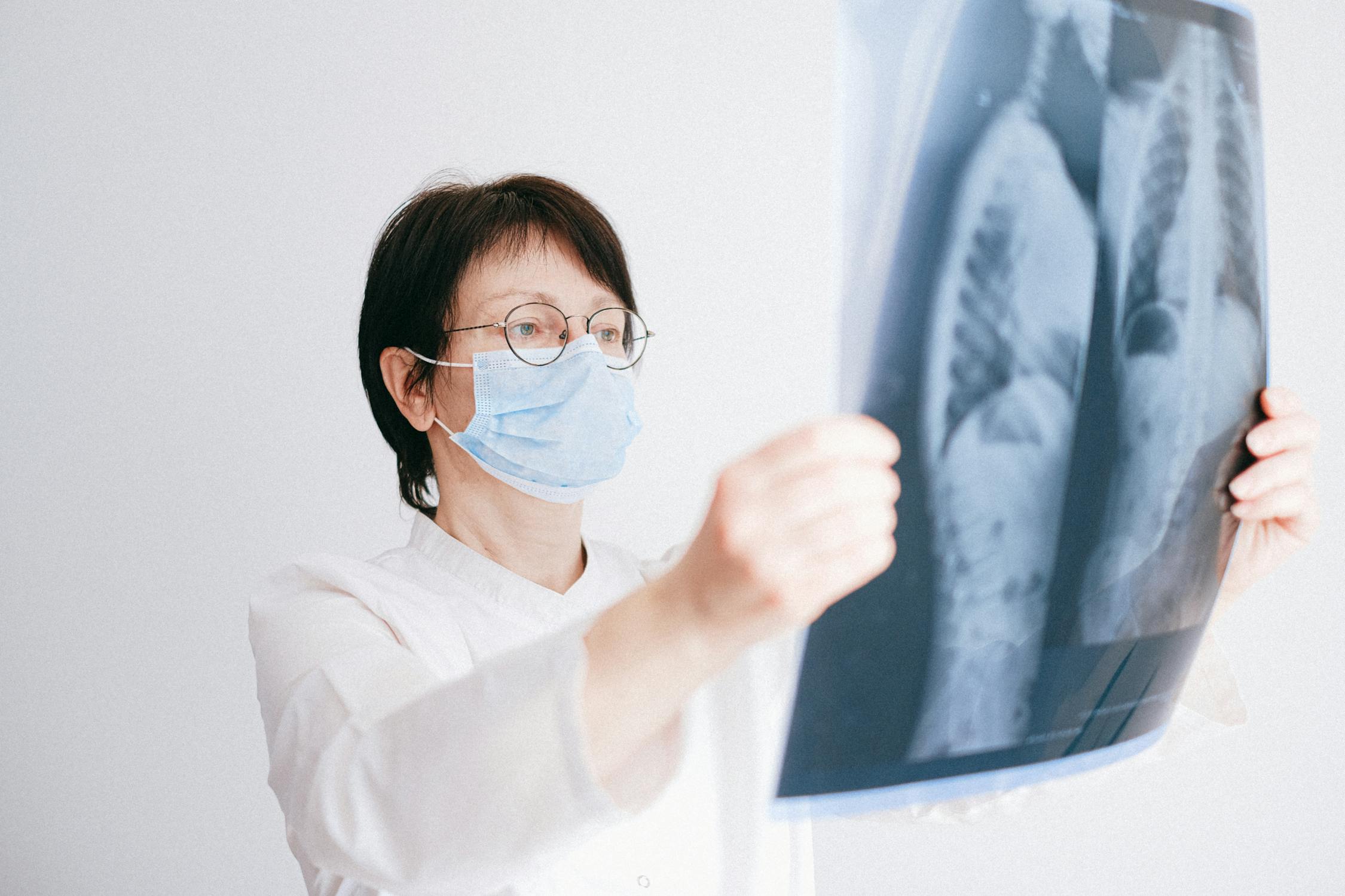 Doctor reviewing a chest X-ray image of lungs.